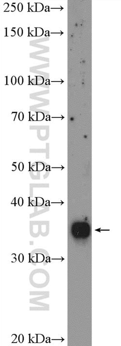 RFC2 Rabbit anti-Human, Mouse, Rat, Polyclonal, Proteintech 150 &mu;L;