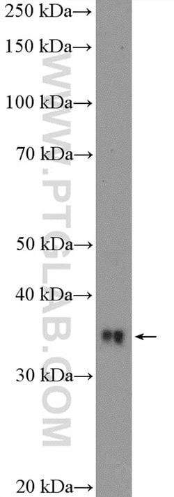RFC2 Rabbit anti-Human, Mouse, Rat, Polyclonal, Proteintech 150 &mu;L;