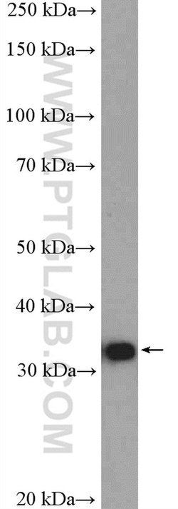 RFC2 Rabbit anti-Human, Mouse, Rat, Polyclonal, Proteintech 150 &mu;L;
