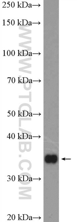 RFC2 Rabbit anti-Human, Mouse, Rat, Polyclonal, Proteintech 150 &mu;L;