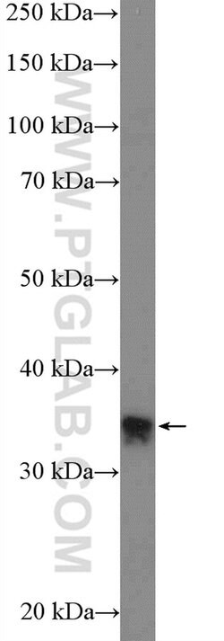 RFC2 Rabbit anti-Human, Mouse, Rat, Polyclonal, Proteintech 150 &mu;L;