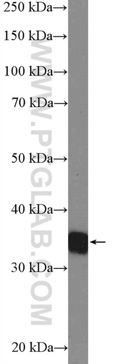 RFC2 Rabbit anti-Human, Mouse, Rat, Polyclonal, Proteintech 150 &mu;L;