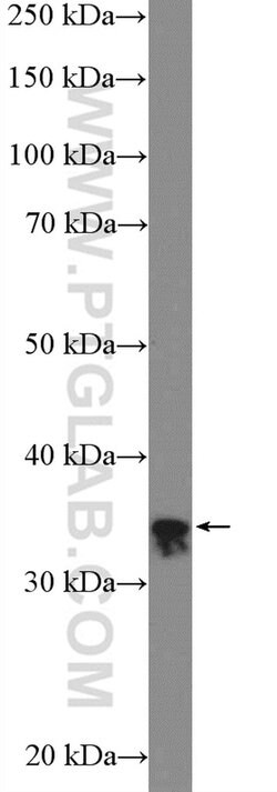 RFC2 Rabbit anti-Human, Mouse, Rat, Polyclonal, Proteintech 150 &mu;L;