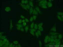 RPA2 Rabbit anti-Human, Mouse, Rat, Polyclonal, Proteintech:Antibodies:Primary