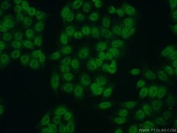 RPA2 Rabbit anti-Human, Mouse, Rat, Polyclonal, Proteintech:Antibodies:Primary