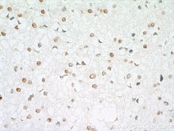 RPA2 Rabbit anti-Human, Mouse, Rat, Polyclonal, Proteintech:Antibodies:Primary