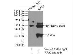 RPA2 Rabbit anti-Human, Mouse, Rat, Polyclonal, Proteintech:Antibodies:Primary