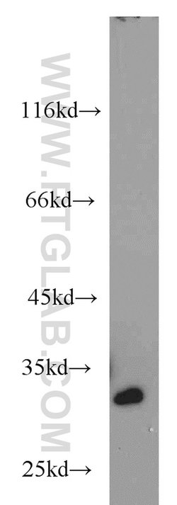 RPA2 Rabbit anti-Human, Mouse, Rat, Polyclonal, Proteintech:Antibodies:Primary