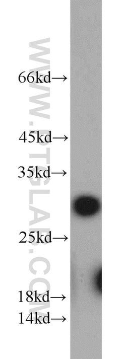 RPA2 Rabbit anti-Human, Mouse, Rat, Polyclonal, Proteintech:Antibodies:Primary