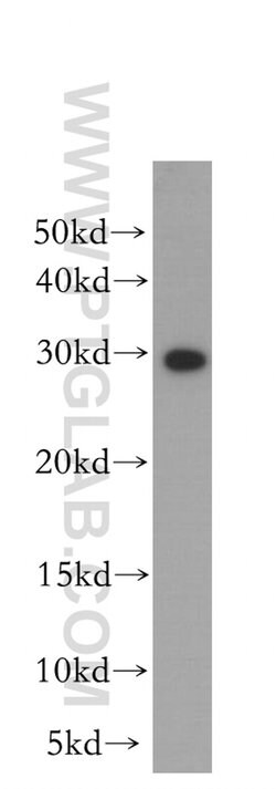 RPA2 Rabbit anti-Human, Mouse, Rat, Polyclonal, Proteintech:Antibodies:Primary