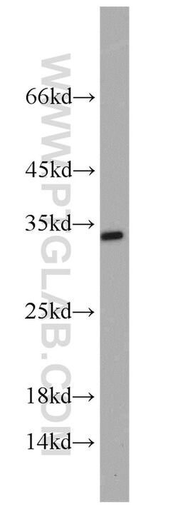 RPA2 Rabbit anti-Human, Mouse, Rat, Polyclonal, Proteintech:Antibodies:Primary