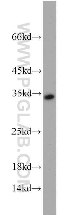 RPA2 Rabbit anti-Human, Mouse, Rat, Polyclonal, Proteintech:Antibodies:Primary