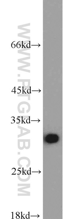 RPA2 Rabbit anti-Human, Mouse, Rat, Polyclonal, Proteintech:Antibodies:Primary
