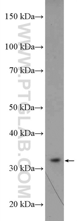RPA2 Rabbit anti-Human, Mouse, Rat, Polyclonal, Proteintech:Antibodies:Primary