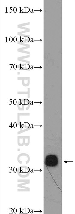 RPA2 Rabbit anti-Human, Mouse, Rat, Polyclonal, Proteintech:Antibodies:Primary