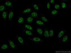 BCAS2 Rabbit anti-Human, Mouse, Non-human primate, Rat, Polyclonal, Proteintech