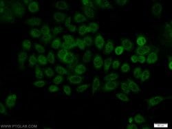 BCAS2 Rabbit anti-Human, Mouse, Non-human primate, Rat, Polyclonal, Proteintech