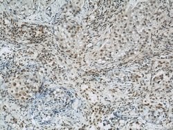 BCAS2 Rabbit anti-Human, Mouse, Non-human primate, Rat, Polyclonal, Proteintech