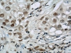 BCAS2 Rabbit anti-Human, Mouse, Non-human primate, Rat, Polyclonal, Proteintech