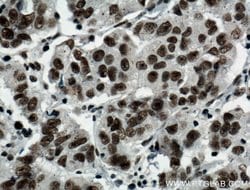 BCAS2 Rabbit anti-Human, Mouse, Non-human primate, Rat, Polyclonal, Proteintech