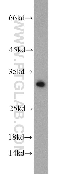BCAS2 Rabbit anti-Human, Mouse, Non-human primate, Rat, Polyclonal, Proteintech