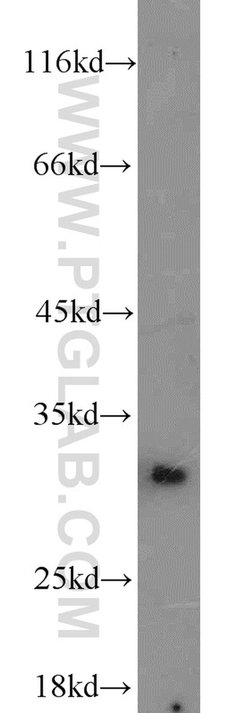 BCAS2 Rabbit anti-Human, Mouse, Non-human primate, Rat, Polyclonal, Proteintech