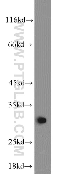BCAS2 Rabbit anti-Human, Mouse, Non-human primate, Rat, Polyclonal, Proteintech