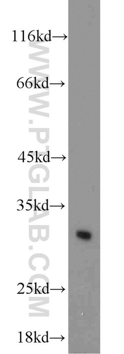 BCAS2 Rabbit anti-Human, Mouse, Non-human primate, Rat, Polyclonal, Proteintech