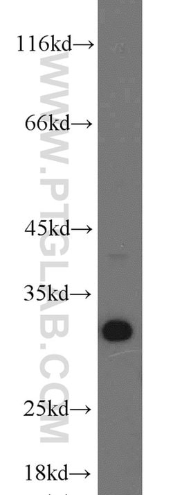BCAS2 Rabbit anti-Human, Mouse, Non-human primate, Rat, Polyclonal, Proteintech