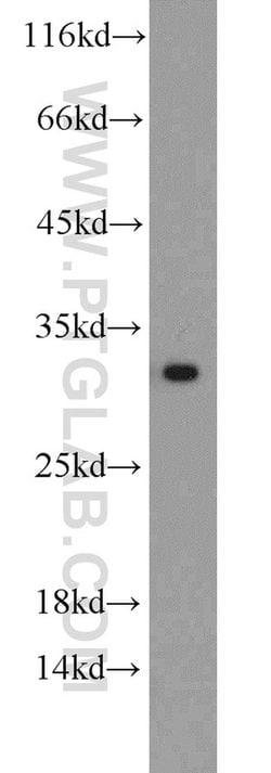 BCAS2 Rabbit anti-Human, Mouse, Non-human primate, Rat, Polyclonal, Proteintech