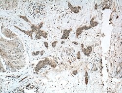 Calpain 3 Rabbit anti-Human, Mouse, Rat, Polyclonal, Proteintech:Antikörper:Primärantikörper