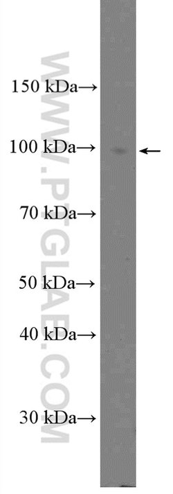 Proteintech Calpain 3 Rabbit anti-Human, Mouse, Rat, Polyclonal, Proteintech