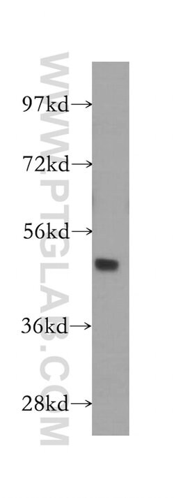 GATA3 Rabbit anti-Human, Mouse, Rat, Polyclonal, Proteintech 150 &mu;L;