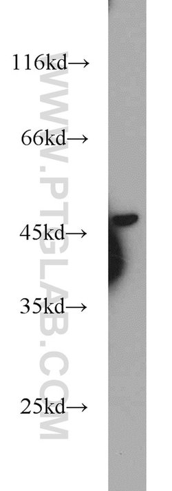 GATA3 Rabbit anti-Human, Mouse, Rat, Polyclonal, Proteintech 150 &mu;L;