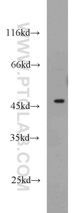 GATA3 Rabbit anti-Human, Mouse, Rat, Polyclonal, Proteintech 150 &mu;L;