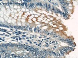 CEA Rabbit anti-Human, Polyclonal, Proteintech:Anticorps:Anticorps primaires