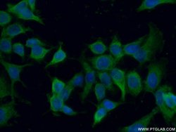 ENOX2 Rabbit anti-Human, Mouse, Polyclonal, Proteintech:Antibodies:Primary