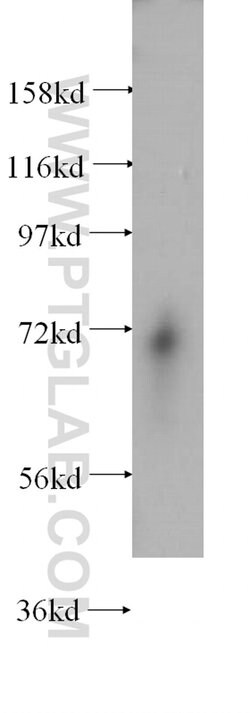 ENOX2 Rabbit anti-Human, Mouse, Polyclonal, Proteintech:Antibodies:Primary