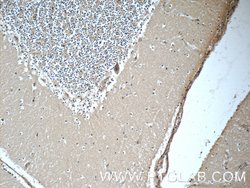 JTV1 Rabbit anti-Human, Mouse, Rat, Polyclonal, Proteintech:Antibodies:Primary