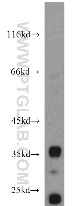 JTV1 Rabbit anti-Human, Mouse, Rat, Polyclonal, Proteintech:Antibodies:Primary