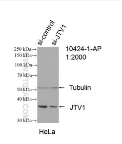 JTV1 Rabbit anti-Human, Mouse, Rat, Polyclonal, Proteintech:Antibodies:Primary