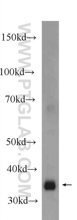 JTV1 Rabbit anti-Human, Mouse, Rat, Polyclonal, Proteintech:Antibodies:Primary