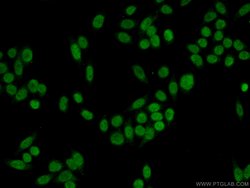 DDB2 Rabbit anti-Human, Mouse, Rat, Polyclonal, Proteintech:Antibodies:Primary