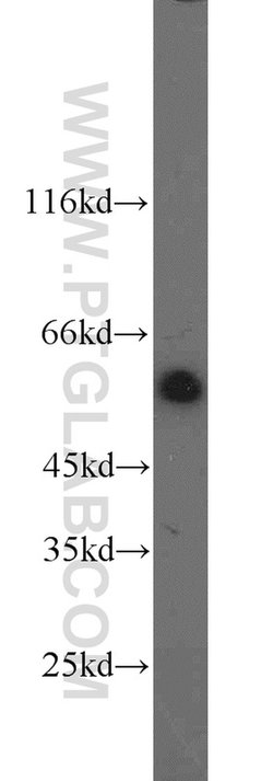 DDB2 Rabbit anti-Human, Mouse, Rat, Polyclonal, Proteintech:Antibodies:Primary
