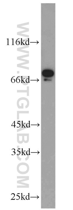 TORC1 Rabbit anti-Human, Mouse, Polyclonal, Proteintech:Antibodies:Primary