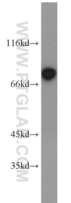 TORC1 Rabbit anti-Human, Mouse, Polyclonal, Proteintech:Antibodies:Primary