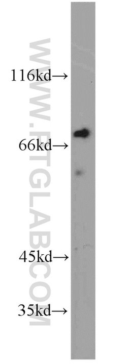 TORC1 Rabbit anti-Human, Mouse, Polyclonal, Proteintech:Antibodies:Primary