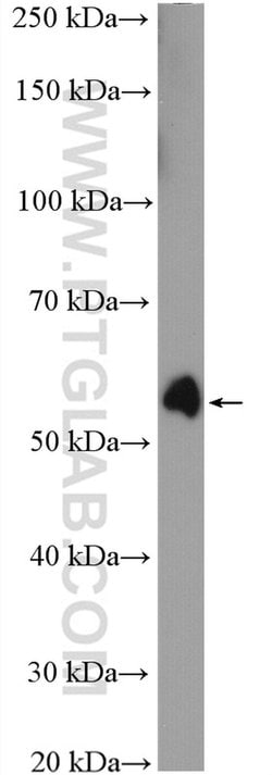 P53 Rabbit anti-Human, Mouse, Rat, Polyclonal, Proteintech 150 &mu;L | Buy Online | Proteintech Group Inc | Fisher Scientific