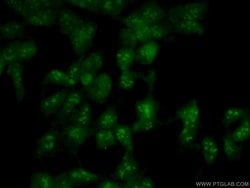 Proteintech NOP2 Rabbit anti-Human, Mouse, Rat, Polyclonal, Proteintech