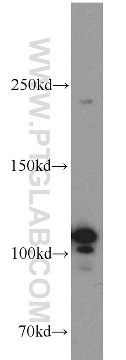 NOP2 Rabbit anti-Human, Mouse, Rat, Polyclonal, Proteintech:Antikörper:Primärantikörper